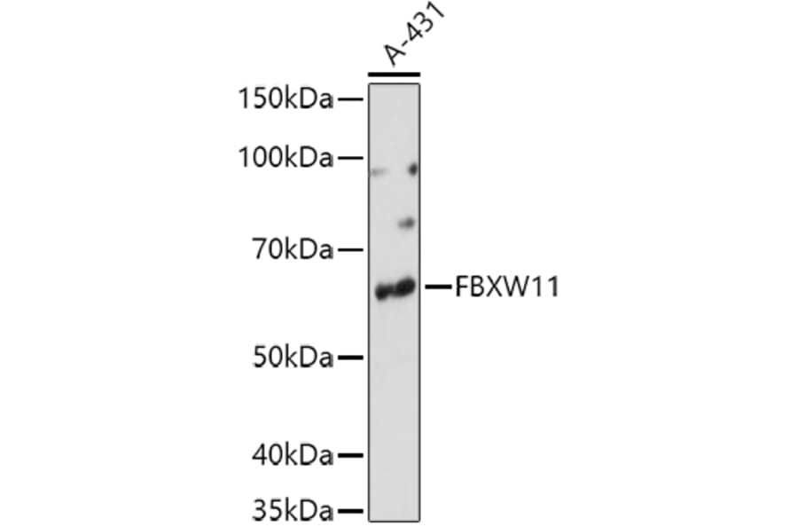Western Blot - Anti-FBXW11 Antibody (A15895) - Antibodies.com