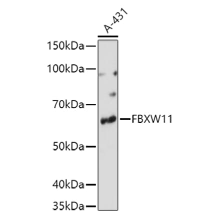 Western Blot - Anti-FBXW11 Antibody (A15895) - Antibodies.com