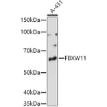 Western Blot - Anti-FBXW11 Antibody (A15895) - Antibodies.com