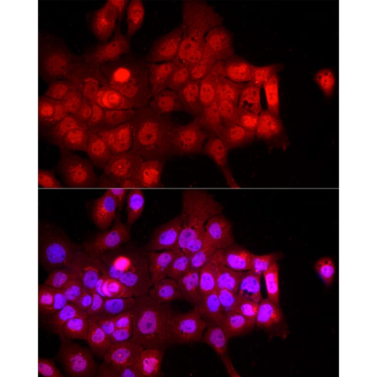 Immunofluorescence - Anti-FBXW11 Antibody (A15895) - Antibodies.com