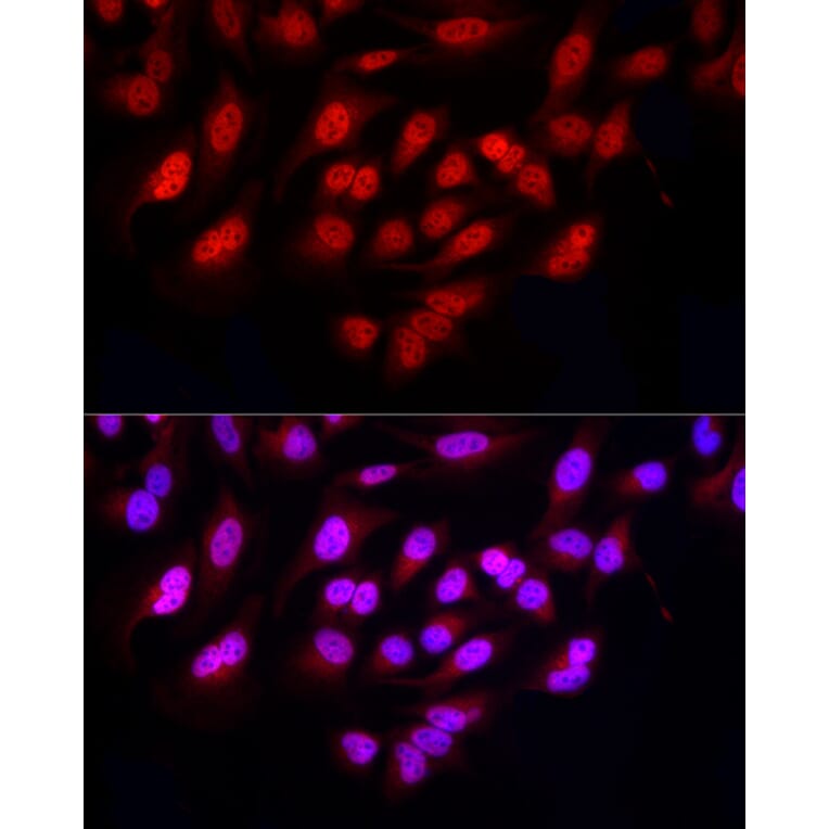 Immunofluorescence - Anti-FBXW11 Antibody (A15895) - Antibodies.com