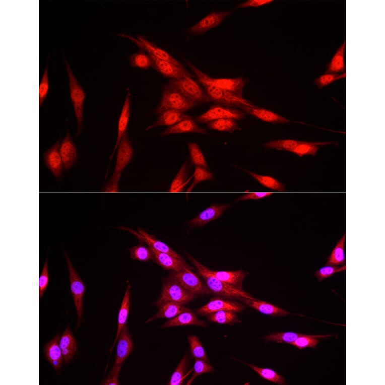 Immunofluorescence - Anti-FBXW11 Antibody (A15895) - Antibodies.com
