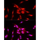 Immunofluorescence - Anti-FBXW11 Antibody (A15895) - Antibodies.com