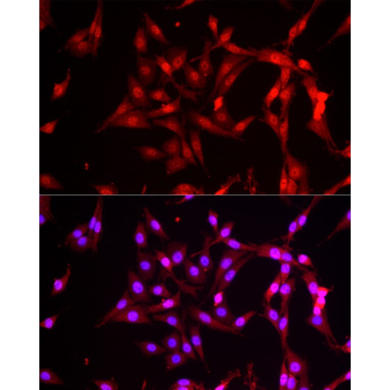 Immunofluorescence - Anti-FBXW11 Antibody (A15895) - Antibodies.com