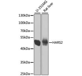Western Blot - Anti-HARS2 Antibody (A15896) - Antibodies.com