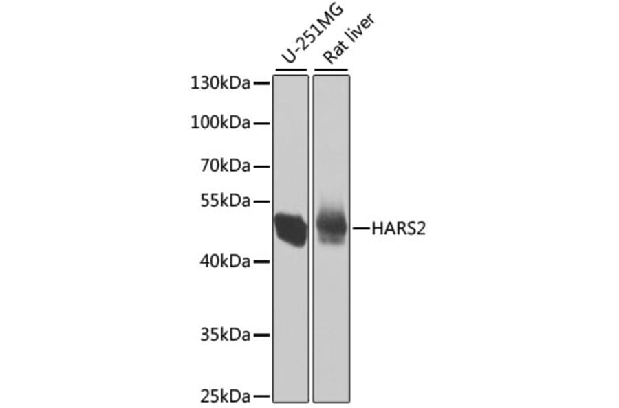 Western Blot - Anti-HARS2 Antibody (A7785) - Antibodies.com