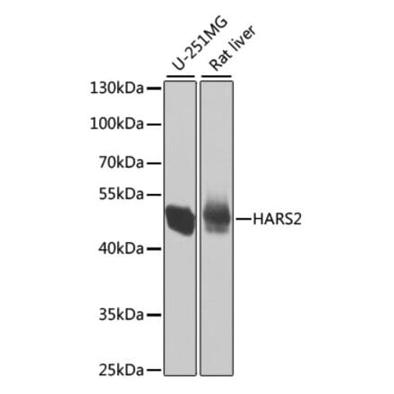 Western Blot - Anti-HARS2 Antibody (A7785) - Antibodies.com