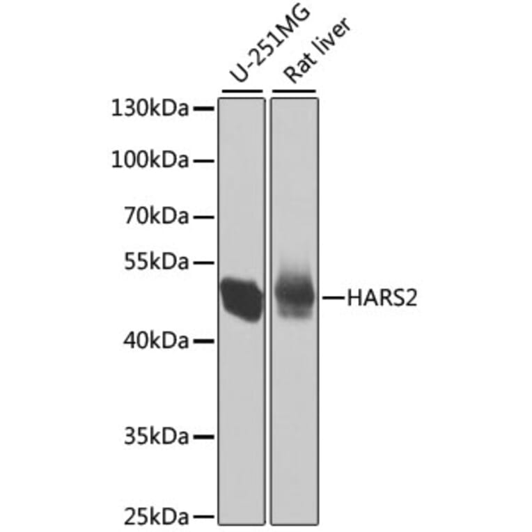 Western Blot - Anti-HARS2 Antibody (A7785) - Antibodies.com