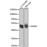 Western Blot - Anti-HARS2 Antibody (A7785) - Antibodies.com