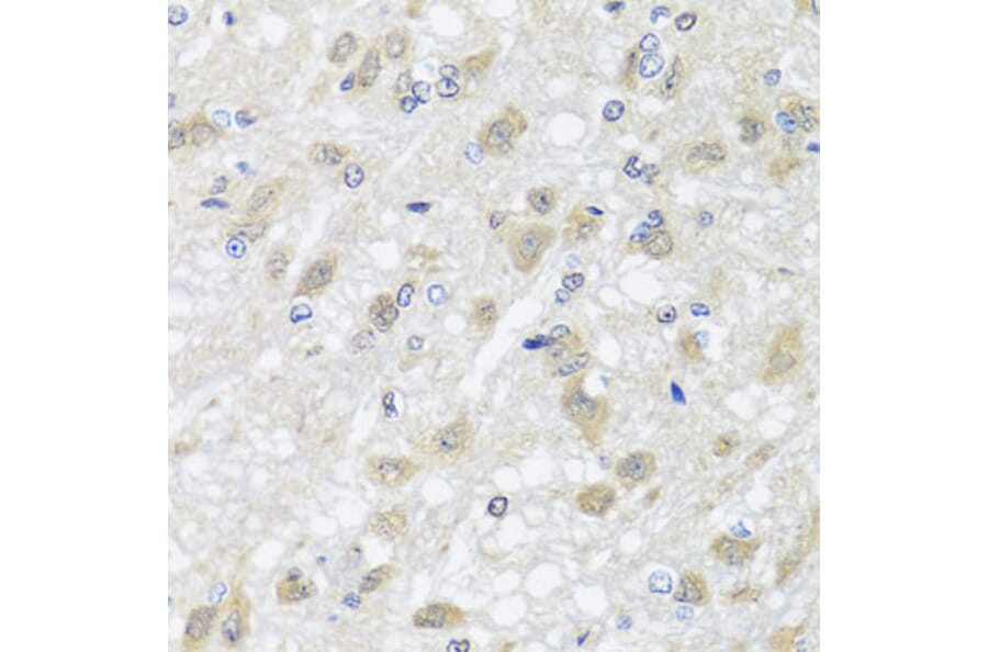 Immunohistochemistry - Anti-HARS2 Antibody (A7785) - Antibodies.com