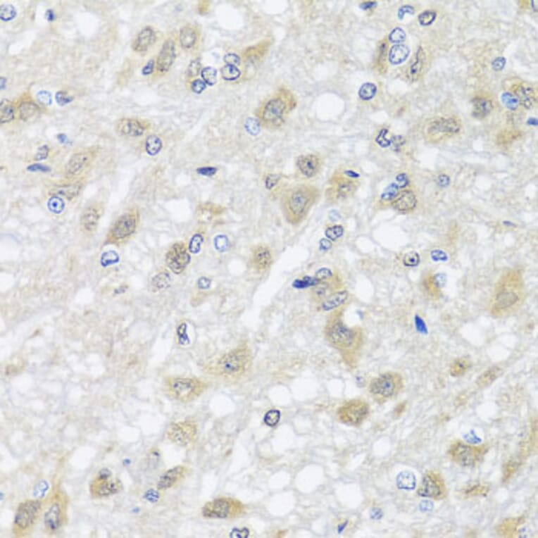 Immunohistochemistry - Anti-HARS2 Antibody (A7785) - Antibodies.com