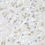 Immunohistochemistry - Anti-HARS2 Antibody (A7785) - Antibodies.com