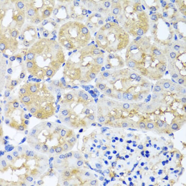 Immunohistochemistry - Anti-HARS2 Antibody (A7785) - Antibodies.com