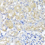 Immunohistochemistry - Anti-HARS2 Antibody (A7785) - Antibodies.com