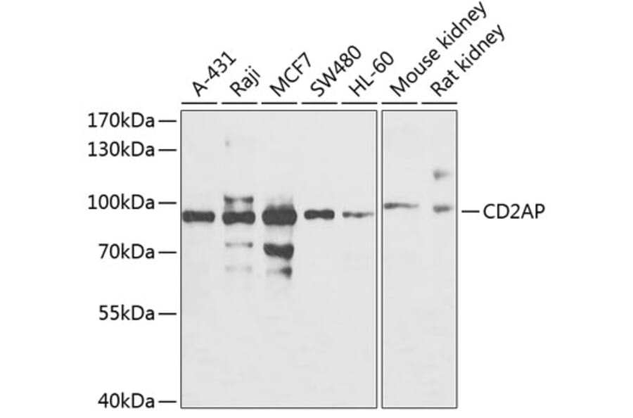 Western Blot - Anti-CD2AP Antibody (A15897) - Antibodies.com