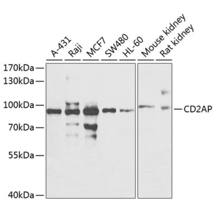 Western Blot - Anti-CD2AP Antibody (A15897) - Antibodies.com