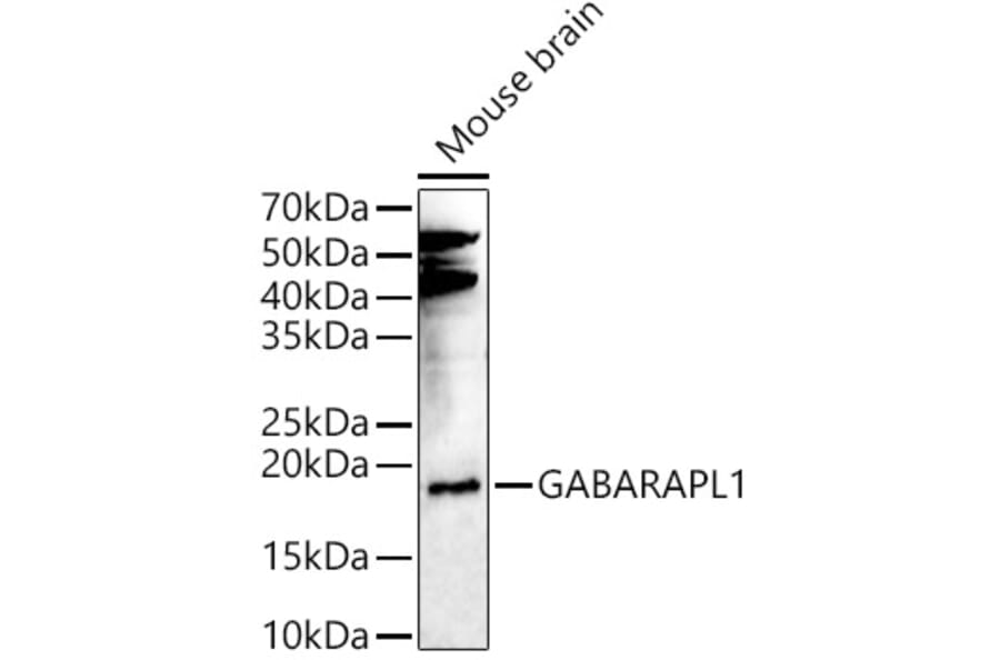 Western Blot - Anti-GABARAPL1 Antibody (A15898) - Antibodies.com