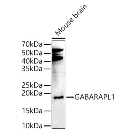 Western Blot - Anti-GABARAPL1 Antibody (A15898) - Antibodies.com