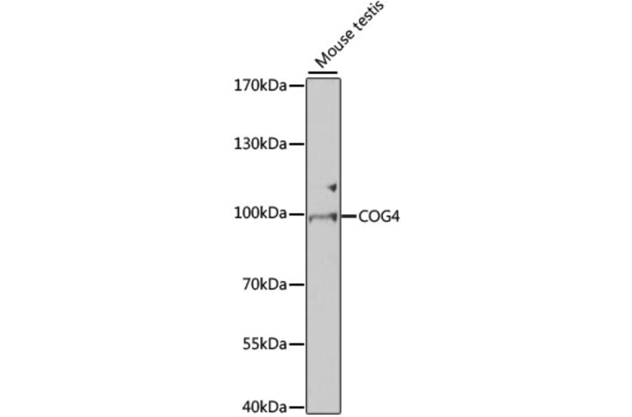 Western Blot - Anti-COG4 Antibody (A7792) - Antibodies.com