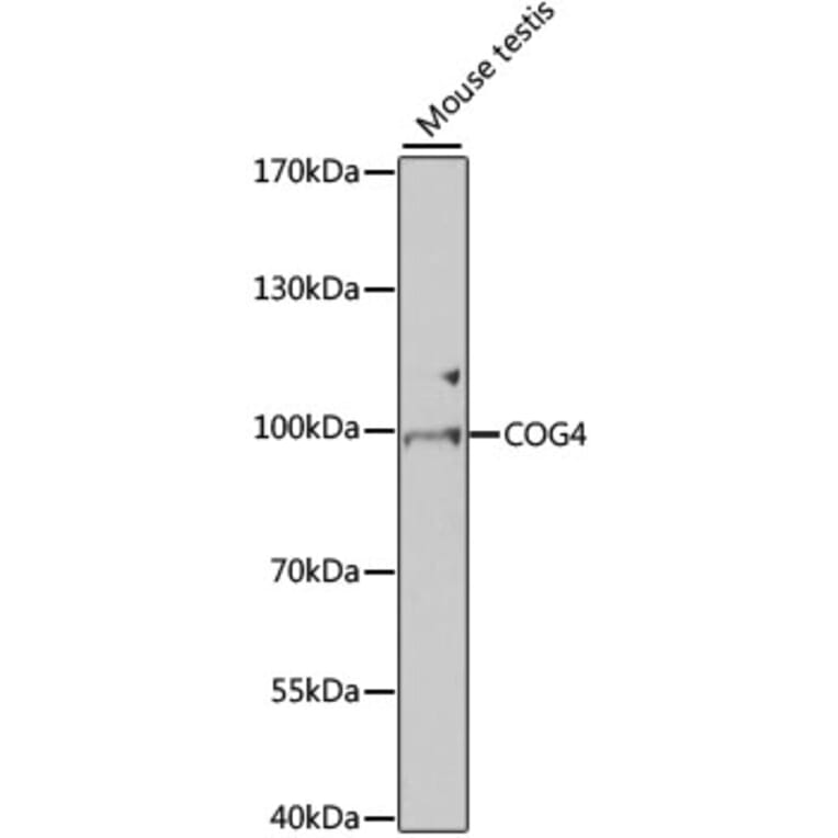 Western Blot - Anti-COG4 Antibody (A7792) - Antibodies.com