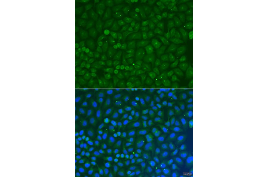 Immunofluorescence - Anti-COG4 Antibody (A7792) - Antibodies.com