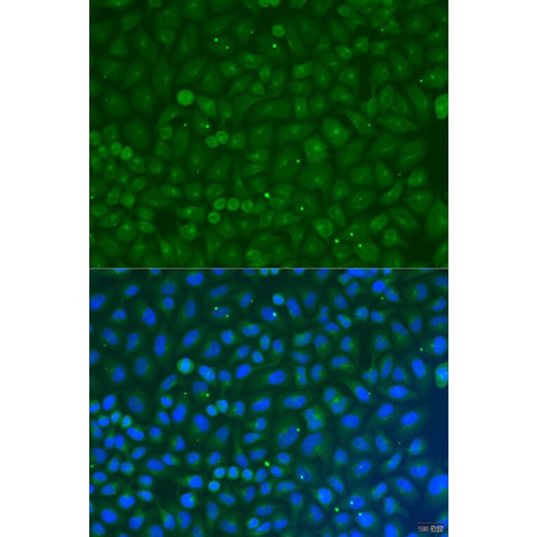 Immunofluorescence - Anti-COG4 Antibody (A7792) - Antibodies.com