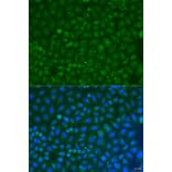 Immunofluorescence - Anti-COG4 Antibody (A7792) - Antibodies.com