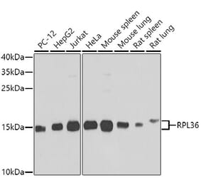 Western Blot - Anti-RPL36 Antibody (A15900) - Antibodies.com