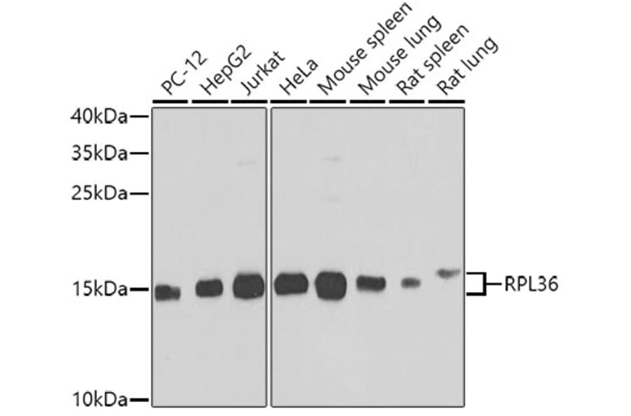 Western Blot - Anti-RPL36 Antibody (A15900) - Antibodies.com