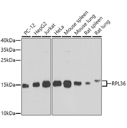 Western Blot - Anti-RPL36 Antibody (A15900) - Antibodies.com