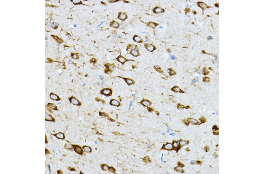 Immunohistochemistry - Anti-RPL36 Antibody (A15900) - Antibodies.com