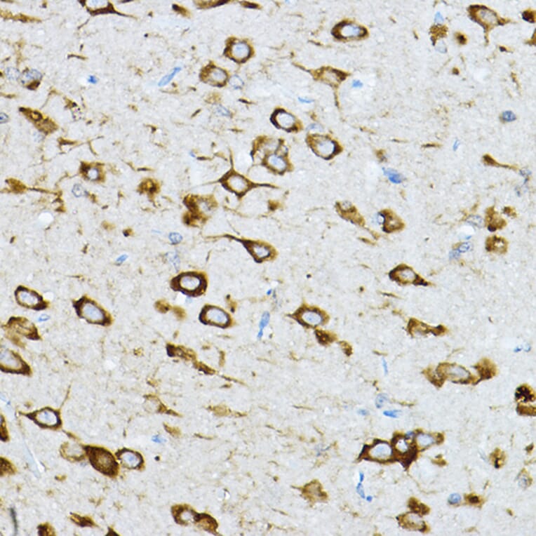 Immunohistochemistry - Anti-RPL36 Antibody (A15900) - Antibodies.com