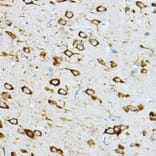 Immunohistochemistry - Anti-RPL36 Antibody (A15900) - Antibodies.com