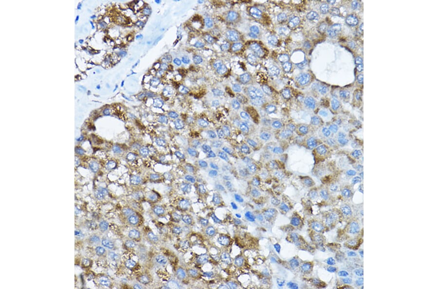 Immunohistochemistry - Anti-RPL36 Antibody (A15900) - Antibodies.com
