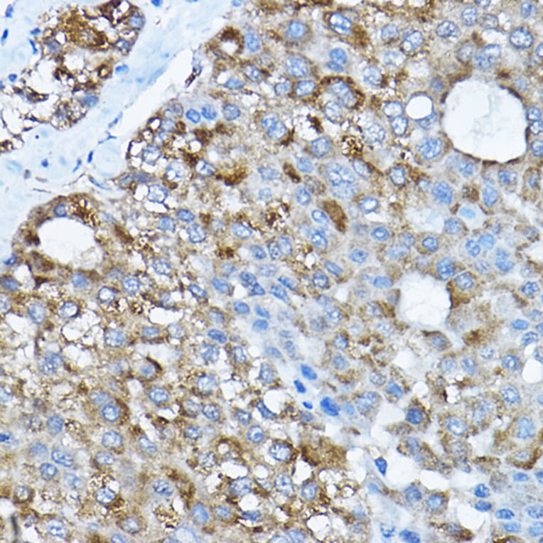 Immunohistochemistry - Anti-RPL36 Antibody (A15900) - Antibodies.com
