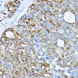 Immunohistochemistry - Anti-RPL36 Antibody (A15900) - Antibodies.com