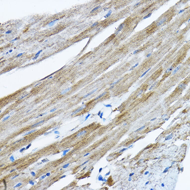 Immunohistochemistry - Anti-RPL36 Antibody (A15900) - Antibodies.com