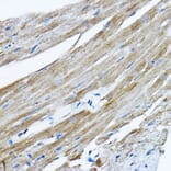 Immunohistochemistry - Anti-RPL36 Antibody (A15900) - Antibodies.com