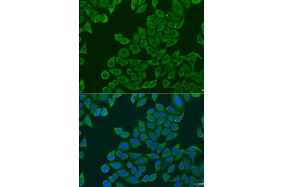 Immunofluorescence - Anti-RPL36 Antibody (A15900) - Antibodies.com