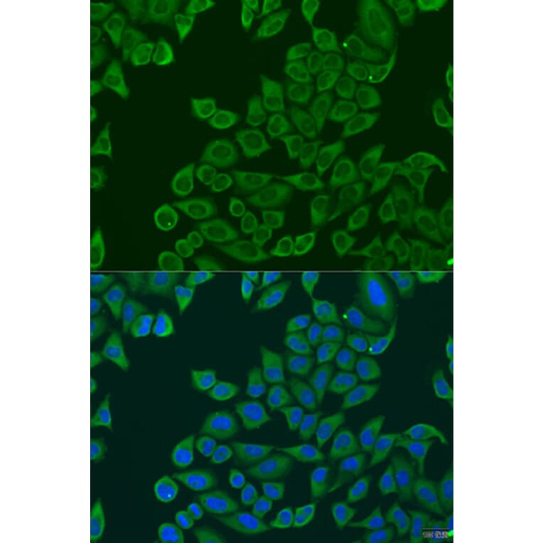 Immunofluorescence - Anti-RPL36 Antibody (A15900) - Antibodies.com