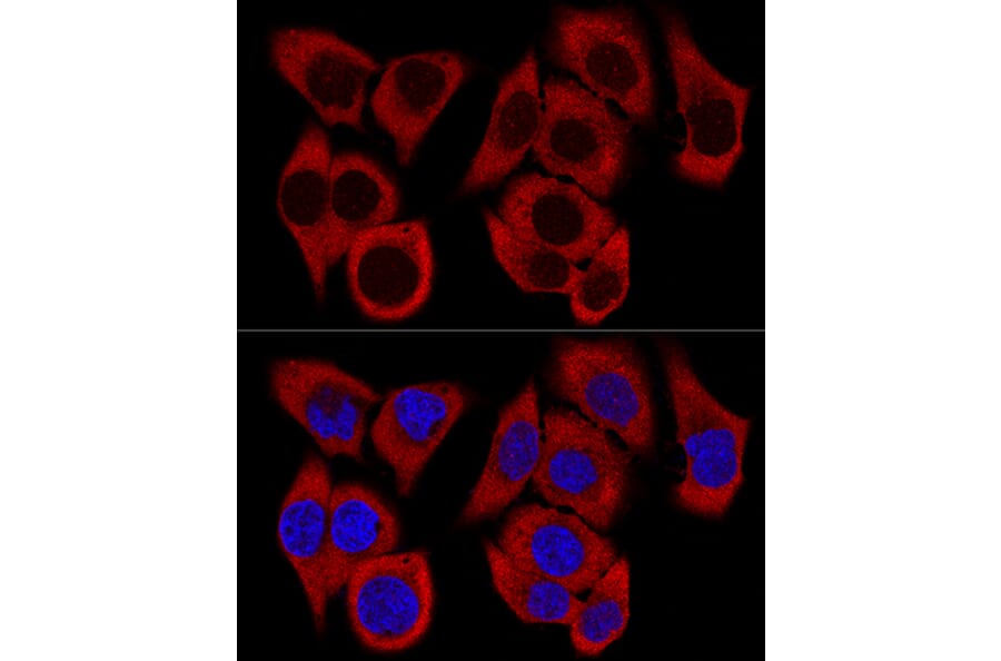 Immunofluorescence - Anti-RPL36 Antibody (A15900) - Antibodies.com