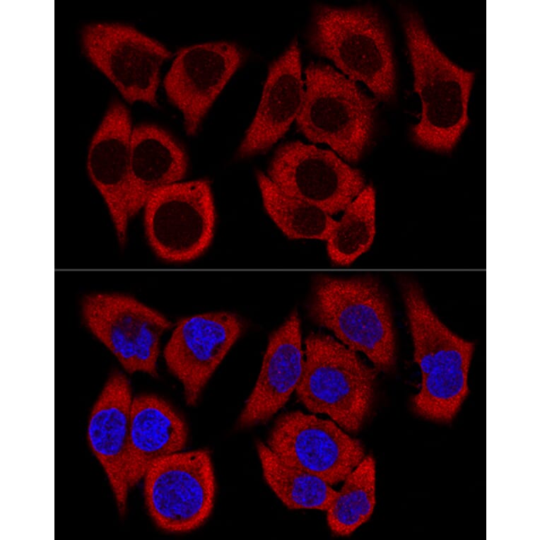 Immunofluorescence - Anti-RPL36 Antibody (A15900) - Antibodies.com