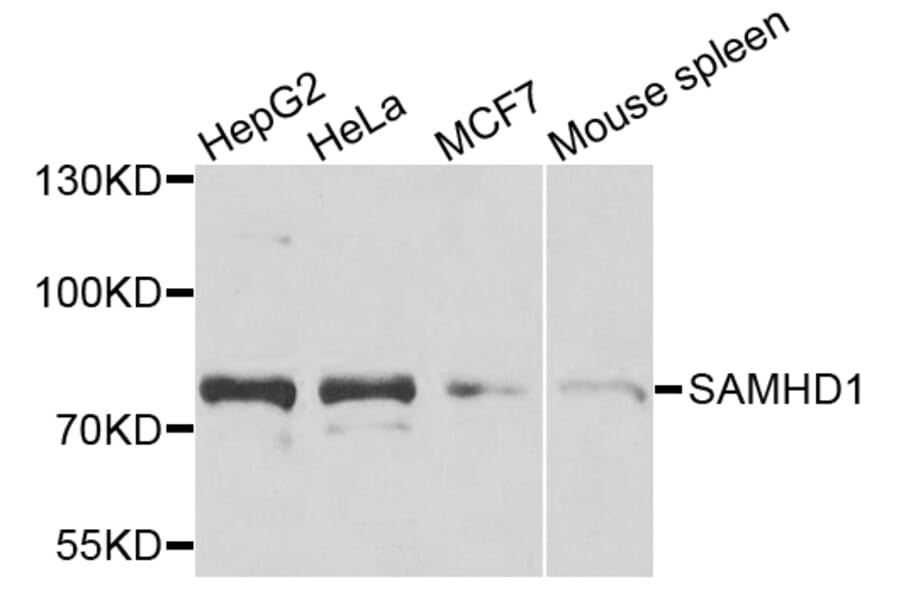 Western Blot - Anti-SAMHD1 Antibody (A15901) - Antibodies.com