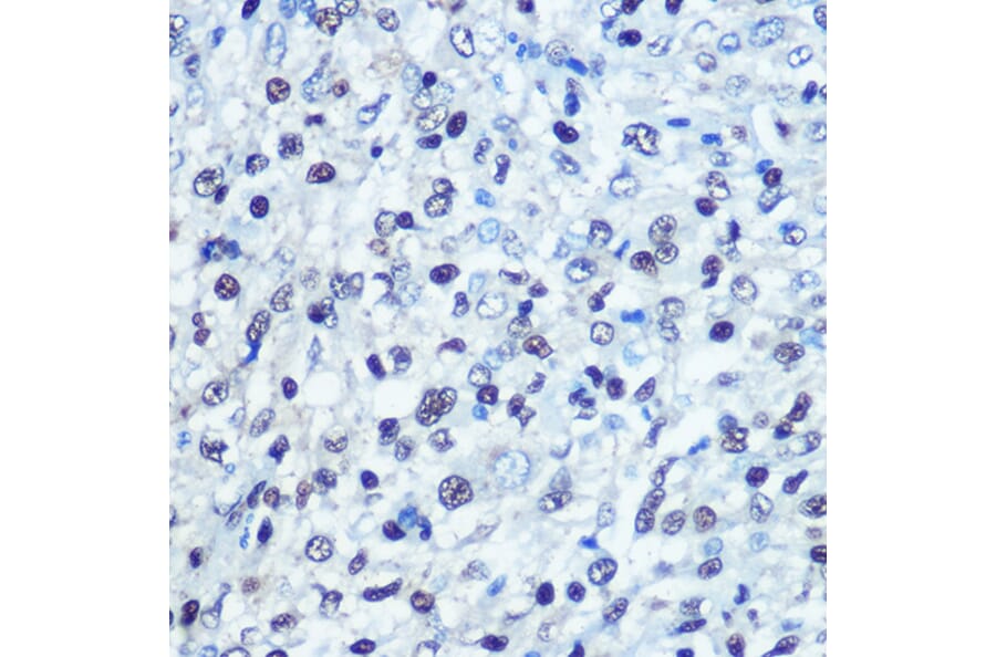 Immunohistochemistry - Anti-SAMHD1 Antibody (A15901) - Antibodies.com