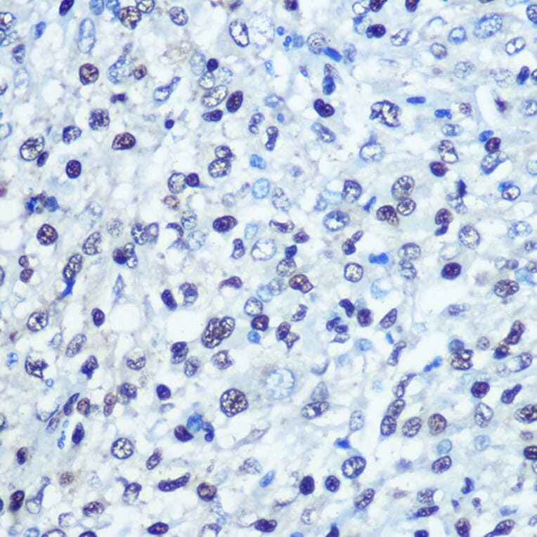 Immunohistochemistry - Anti-SAMHD1 Antibody (A15901) - Antibodies.com