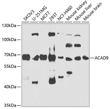 Western blot analysis of extracts of various cell lines, using Anti-ACAD9 Antibody (A7798) at 1:1,000 dilution.
Secondary antibody: Goat Anti-Rabbit IgG (H+L) (HRP) (AS014) at 1:10,000 dilution.
Lysates / proteins: 25µg per lane.
Blocking buffer: 3% non-fat dry milk in TBST.
Detection: ECL Basic Kit (RM00020).
Exposure time: 90s.