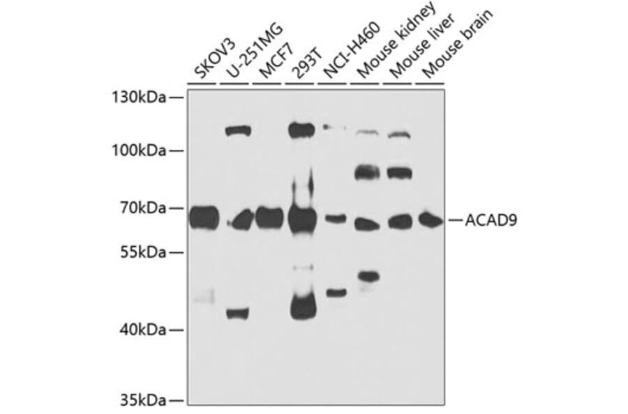 Western Blot - Anti-ACAD9 Antibody (A15902) - Antibodies.com