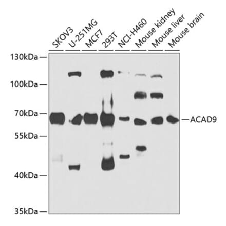 Western Blot - Anti-ACAD9 Antibody (A15902) - Antibodies.com
