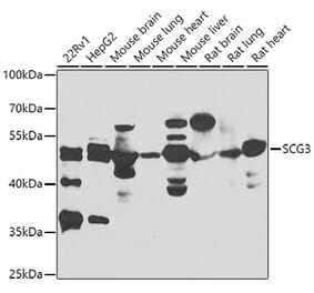 Western Blot - Anti-SCG3 Antibody (A7799) - Antibodies.com