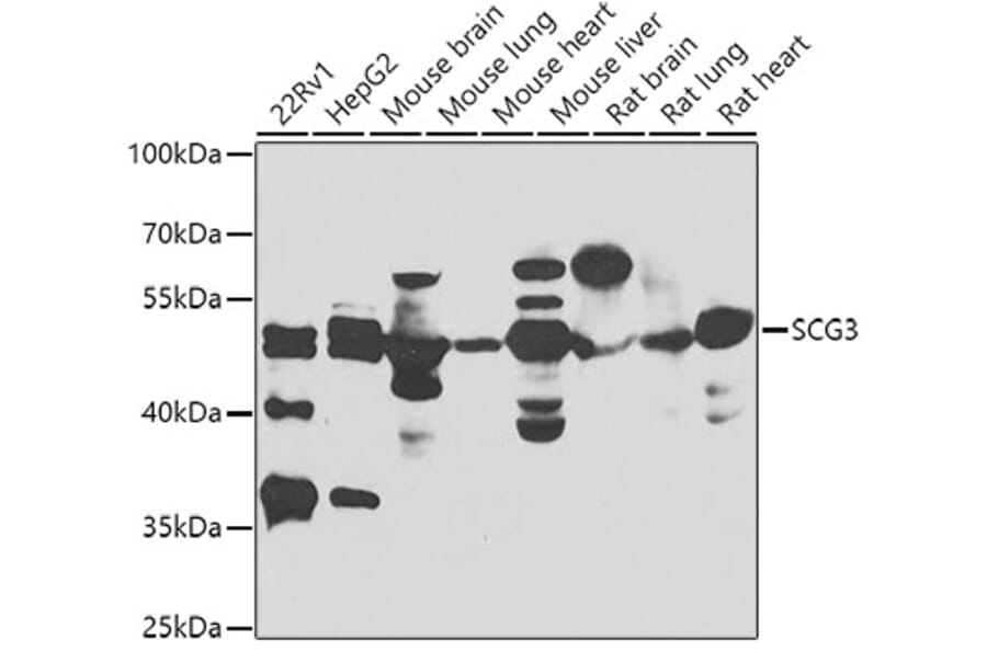Western Blot - Anti-SCG3 Antibody (A7799) - Antibodies.com